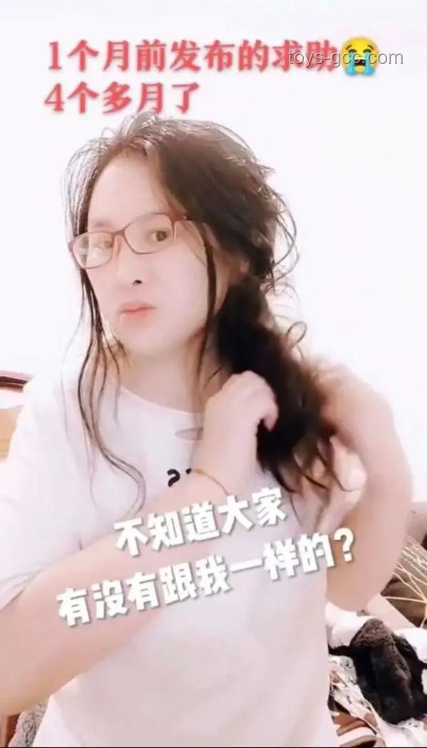 洗头后立即梳头加重脱发案例分析